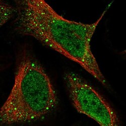 CSN3 Antibody, Novus Biologicals:Antibodies:Primary Antibodies